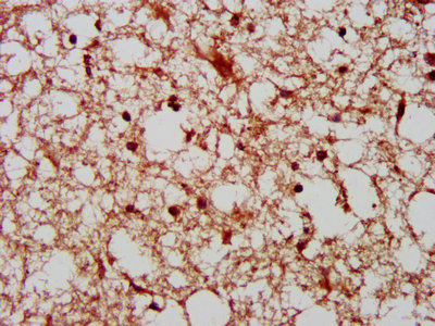 PAK4 Antibody - IHC image of PAK4 Antibody diluted at 1:800 and staining in paraffin-embedded human brain tissue performed on a Leica BondTM system. After dewaxing and hydration, antigen retrieval was mediated by high pressure in a citrate buffer (pH 6.0). Section was blocked with 10% normal goat serum 30min at RT. Then primary antibody (1% BSA) was incubated at 4°C overnight. The primary is detected by a biotinylated secondary antibody and visualized using an HRP conjugated SP system.
