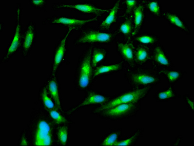 PAK4 Antibody - Immunofluorescence staining of Hela cells with PAK4 Antibody at 1:266, counter-stained with DAPI. The cells were fixed in 4% formaldehyde, permeabilized using 0.2% Triton X-100 and blocked in 10% normal Goat Serum. The cells were then incubated with the antibody overnight at 4°C. The secondary antibody was Alexa Fluor 488-congugated AffiniPure Goat Anti-Rabbit IgG(H+L).