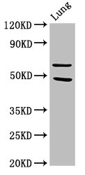 PAK4 Antibody - Western Blot Positive WB detected in: Rat lung tissue All lanes: PAK4 antibody at 3.2µg/ml Secondary Goat polyclonal to rabbit IgG at 1/50000 dilution Predicted band size: 65, 48, 49, 55 kDa Observed band size: 65 kDa