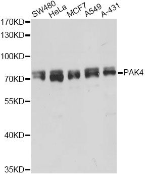 PAK4 Antibody - Western blot analysis of extracts of various cell lines, using PAK4 antibody at 1:5000 dilution. The secondary antibody used was an HRP Goat Anti-Rabbit IgG (H+L) at 1:10000 dilution. Lysates were loaded 25ug per lane and 3% nonfat dry milk in TBST was used for blocking. An ECL Kit was used for detection and the exposure time was 5s.