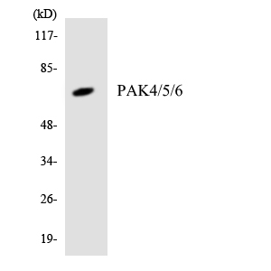 PAK4 + PAK5 + PAK6 Antibody - Western blot analysis of the lysates from Jurkat cells using PAK4/5/6 antibody.