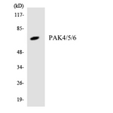 PAK4 + PAK5 + PAK6 Antibody - Western blot analysis of the lysates from Jurkat cells using PAK4/5/6 antibody.
