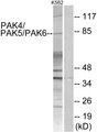 PAK4 + PAK5 + PAK6 Antibody - Western blot analysis of extracts from K562 cells, treated with PMA (125ng/ml, 30mins), using PAK4/5/6 (Ab-474) antibody.