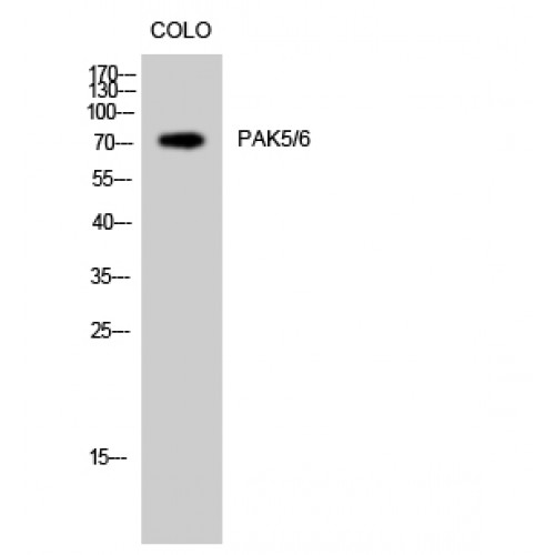 PAK5 + PAK6 Antibody - Western blot of PAK5/6 antibody