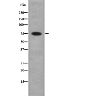 PAK5 + PAK6 Antibody - Western blot analysis of PAK5/6 using COLO whole cells lysates