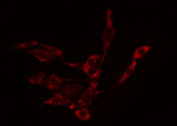 PAK5 + PAK6 Antibody - Staining LOVO cells by IF/ICC. The samples were fixed with PFA and permeabilized in 0.1% Triton X-100, then blocked in 10% serum for 45 min at 25°C. The primary antibody was diluted at 1:200 and incubated with the sample for 1 hour at 37°C. An Alexa Fluor 594 conjugated goat anti-rabbit IgG (H+L) Ab, diluted at 1/600, was used as the secondary antibody.