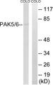 PAK5 + PAK6 Antibody - Western blot analysis of extracts from COLO cells, using PAK5/6 (Ab-602/560) antibody.