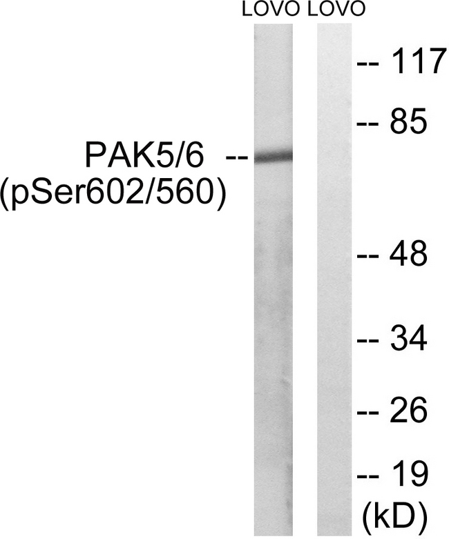 PAK5 + PAK6 Antibody - Western blot analysis of lysates from LOVO cells treated with PMA 125ng/ml 30', using PAK5/6 (Phospho-Ser602/Ser560) Antibody. The lane on the right is blocked with the phospho peptide.