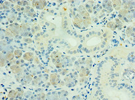 PAK6 Antibody - Immunohistochemistry of paraffin-embedded human pancreatic tissue using PAK6 Antibody at dilution of 1:100