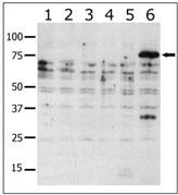 PAK6 Antibody - Western blot of anti-PAK6 antibody in lysates from transiently transfected COS7 cells. Lane 1: negative control, Lane 2: PAK1-expressing cells, Lane 3: PAK2-expressing cells, Lane 4: PAK4-expressing cells, Lane 5: PAK5-expressing cells, and Lane 6: PAK6-expressing cells. PAK6 (arrow) was detected using purified antibody. Data is kindly provided by Drs. Z.M. Jaffer and J. Chernoff from the Fox Chase Cancer Center (Philadelphia, PA).