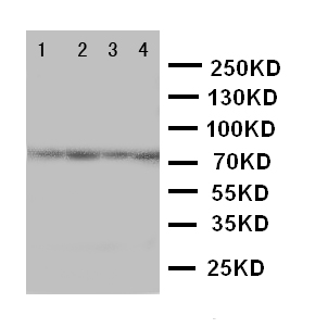 PAK6 Antibody - WB of PAK6 antibody. Lane 1: HELA Cell Lysate. Lane 2: 293T Cell Lysate. Lane 3: RAJI Cell Lysate. Lane 4: COLO320 Cell Lysate.