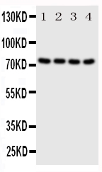 PAK6 Antibody - Anti-PAK6 antibody, Western blotting All lanes: Anti PAK6 at 0.5ug/ml Lane 1: HELA Whole Cell Lysate at 40ug Lane 2: 293T Whole Cell Lysate at 40ug Lane 3: RAJI Whole Cell Lysate at 40ug Lane 4: COLO320 Whole Cell Lysate at 40ug Predicted bind size: 75KD Observed bind size: 75KD