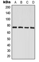 PAK6 Antibody - Western blot analysis of PAK6 expression in HeLa (A); LOVO (B); mouse brain (C); rat brain (D) whole cell lysates.