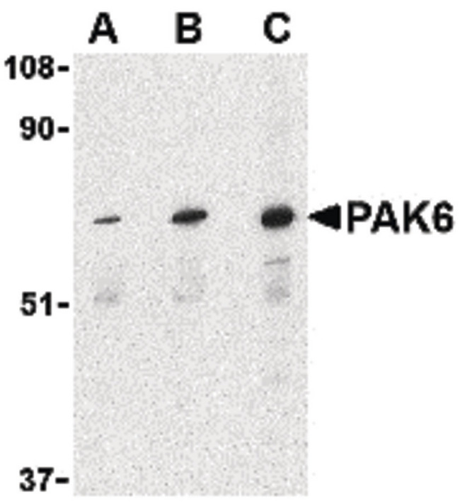 PAK6 Antibody - Western blot of PAK6 in Raji lysate with PAK6 antibody at (A) 1, (B) 2, and (C) 4 ug/ml.
