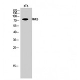 PAK7/PAK5 Antibody - Western blot of PAK5 antibody