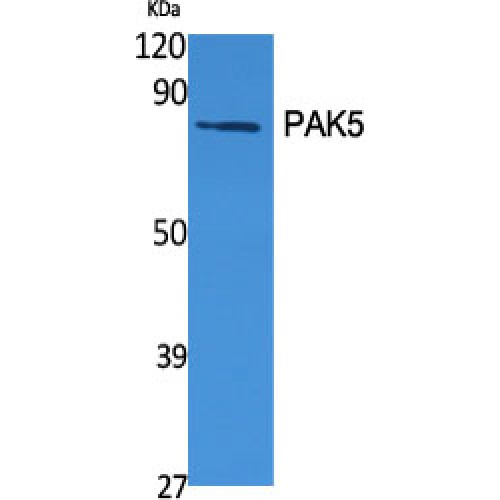 PAK7/PAK5 Antibody - Western blot of PAK5 antibody