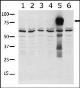 PAK7/PAK5 Antibody - Western blot of anti-PAK5 antibody in lysates from transiently transfected COS7 cells. Lane 1: negative control, Lane 2: PAK1-expressing cells, Lane 3: PAK2-expressing cells, Lane 4: PAK4-expressing cells, Lane 5: PAK5-expressing cells, and Lane 6: PAK6-expressing cells. PAK5 (arrow) was detected using purified antibody. Data is kindly provided by Drs. Z.M. Jaffer and J. Chernoff from the Fox Chase Cancer Center (Philadelphia, PA).