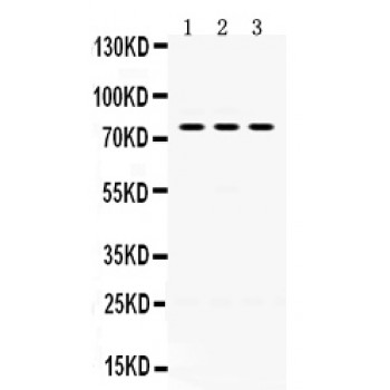 PAK7/PAK5 Antibody - PAK5 antibody Western blot. All lanes: Anti PAK5 at 0.5 ug/ml. Lane 1: Rat Brain Tissue Lysate at 50 ug. Lane 2: Mouse Brain Tissue Lysate at 50 ug. Lane 3: U87 Whole Cell Lysate at 40 ug. Predicted band size: 81 kD. Observed band size: 81 kD.
