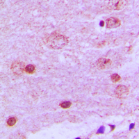 PAK7/PAK5 Antibody - Immunohistochemical analysis of PAK7 staining in human brain formalin fixed paraffin embedded tissue section. The section was pre-treated using heat mediated antigen retrieval with sodium citrate buffer (pH 6.0). The section was then incubated with the antibody at room temperature and detected using an HRP conjugated compact polymer system. DAB was used as the chromogen. The section was then counterstained with hematoxylin and mounted with DPX.