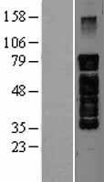 PAK7/PAK5 Protein - Western validation with an anti-DDK antibody * L: Control HEK293 lysate R: Over-expression lysate