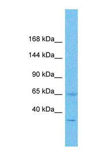 PAL / PAM Antibody - Western blot of Human Stomach Tumor. PAM antibody dilution 1.0 ug/ml.  This image was taken for the unconjugated form of this product. Other forms have not been tested.