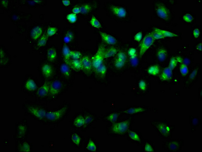 PAL / PAM Antibody - Immunofluorescence staining of Hela cells at a dilution of 1:66, counter-stained with DAPI. The cells were fixed in 4% formaldehyde, permeabilized using 0.2% Triton X-100 and blocked in 10% normal Goat Serum. The cells were then incubated with the antibody overnight at 4 °C.The secondary antibody was Alexa Fluor 488-congugated AffiniPure Goat Anti-Rabbit IgG (H+L) .