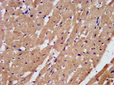 PAL / PAM Antibody - Immunohistochemistry image at a dilution of 1:200 and staining in paraffin-embedded human heart tissue performed on a Leica BondTM system. After dewaxing and hydration, antigen retrieval was mediated by high pressure in a citrate buffer (pH 6.0) . Section was blocked with 10% normal goat serum 30min at RT. Then primary antibody (1% BSA) was incubated at 4 °C overnight. The primary is detected by a biotinylated secondary antibody and visualized using an HRP conjugated SP system.