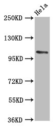 PAL / PAM Antibody - Western Blot Positive WB detected in: Hela whole cell lysate All lanes: PAM antibody at 5.6µg/ml Secondary Goat polyclonal to rabbit IgG at 1/50000 dilution Predicted band size: 109, 97, 101, 99, 107 kDa Observed band size: 109 kDa