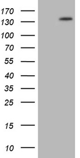 PALB2 Antibody - HEK293T cells were transfected with the pCMV6-ENTRY control. (Left lane) or pCMV6-ENTRY PALB2. (Right lane) cDNA for 48 hrs and lysed. Equivalent amounts of cell lysates. (5 ug per lane) were separated by SDS-PAGE and immunoblotted with anti-PALB2. (1:500)