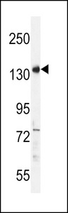 PALB2 Antibody - PALB2 Antibody western blot of HepG2 cell line lysates (35 ug/lane). The PALB2 antibody detected the PALB2 protein (arrow).