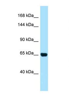 PALB2 Antibody - PALB2 antibody Western blot of HeLa Cell lysate. Antibody concentration 1 ug/ml.  This image was taken for the unconjugated form of this product. Other forms have not been tested.