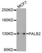 PALB2 Antibody - Western blot analysis of extracts of MCF7 cells.