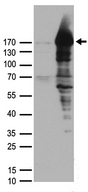 PALB2 Antibody - HEK293T cells were transfected with the pCMV6-ENTRY control. (Left lane) or pCMV6-ENTRY PALB2. (Right lane) cDNA for 48 hrs and lysed. Equivalent amounts of cell lysates. (5 ug per lane) were separated by SDS-PAGE and immunoblotted with anti-PALB2 rabbit polyclonal antibody .