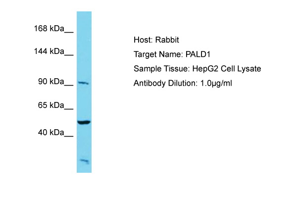 PALD1 / Paladin 1 Antibody -  This image was taken for the unconjugated form of this product. Other forms have not been tested.