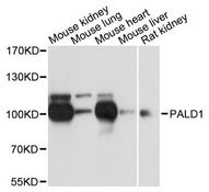 PALD1 / Paladin 1 Antibody - Western blot analysis of extracts of various cell lines, using PALD1 antibody at 1:3000 dilution. The secondary antibody used was an HRP Goat Anti-Rabbit IgG (H+L) at 1:10000 dilution. Lysates were loaded 25ug per lane and 3% nonfat dry milk in TBST was used for blocking. An ECL Kit was used for detection and the exposure time was 1s.