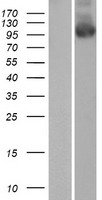 PALD1 / Paladin 1 Protein - Western validation with an anti-DDK antibody * L: Control HEK293 lysate R: Over-expression lysate