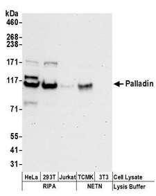 PALLD / Palladin Antibody - Detection of human and mouse Palladin by western blot. Samples: Whole cell lysate (50 µg) from HeLa, HEK293T, Jurkat, mouse TCMK-1, and mouse NIH 3T3 cells prepared using NETN and RIPA lysis buffer. Antibodies: Affinity purified rabbit anti-Palladin antibody used for WB at 0.1 µg/ml. Detection: Chemiluminescence with an exposure time of 30 seconds.