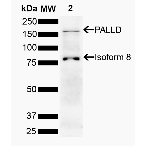 PALLD / Palladin Antibody - Western blot analysis of Human Cervical cancer cell line (HeLa) lysate showing detection of 150.5 kDa PALLD protein using Rabbit Anti-PALLD Polyclonal Antibody. Lane 1: Molecular Weight Ladder (MW). Lane 2: HeLa. Load: 10 µg. Block: 5% Skim Milk powder in TBST. Primary Antibody: Rabbit Anti-PALLD Polyclonal Antibody  at 1:1000 for 2 hours at RT with shaking. Secondary Antibody: Goat Anti-Rabbit IgG: HRP at 1:5000 for 1 hour at RT. Color Development: ECL solution for 5 min at RT. Predicted/Observed Size: 150.5 kDa. Other Band(s): 86 kDa.