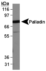 PALLD / Palladin Antibody - Palladin Antibody (1E6) - Western Blot on MDA-MB-231 lysate.  This image was taken for the unconjugated form of this product. Other forms have not been tested.