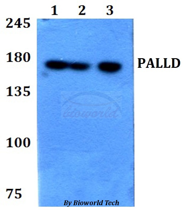 PALLD / Palladin Antibody - Western blot of PALLD antibody at 1:500 dilution. Lane 1: HEK293T whole cell lysate. Lane 2: Raw264.7 whole cell lysate. Lane 3: PC12 whole cell lysate.