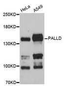 PALLD / Palladin Antibody - Western blot analysis of extracts of various cell lines, using PALLD antibody at 1:3000 dilution. The secondary antibody used was an HRP Goat Anti-Rabbit IgG (H+L) at 1:10000 dilution. Lysates were loaded 25ug per lane and 3% nonfat dry milk in TBST was used for blocking. An ECL Kit was used for detection and the exposure time was 1s.