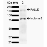 PALLD / Palladin Antibody - Western blot analysis of Human Cervical cancer cell line (HeLa) lysate showing detection of 150.5 kDa PALLD protein using Rabbit Anti-PALLD Polyclonal Antibody. Lane 1: Molecular Weight Ladder (MW). Lane 2: HeLa. Load: 10 µg. Block: 5% Skim Milk powder in TBST. Primary Antibody: Rabbit Anti-PALLD Polyclonal Antibody  at 1:1000 for 2 hours at RT with shaking. Secondary Antibody: Goat Anti-Rabbit IgG: HRP at 1:5000 for 1 hour at RT. Color Development: ECL solution for 5 min at RT. Predicted/Observed Size: 150.5 kDa. Other Band(s): 86 kDa.