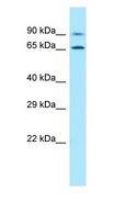PALMD Antibody - PALMD antibody Western Blot of Jurkat.  This image was taken for the unconjugated form of this product. Other forms have not been tested.