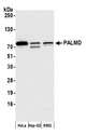 PALMD Antibody - Detection of human PALMD by western blot. Samples: Whole cell lysate (15 µg) from HeLa, Hep-G2, and K562 cells prepared using NETN lysis buffer. Antibody: Affinity purified rabbit anti-PALMD antibody used for WB at 1:1000. Detection: Chemiluminescence with an exposure time of 30 seconds.