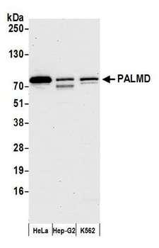 PALMD Antibody - Detection of human PALMD by western blot. Samples: Whole cell lysate (15 µg) from HeLa, Hep-G2, and K562 cells prepared using NETN lysis buffer. Antibody: Affinity purified rabbit anti-PALMD antibody used for WB at 1:1000. Detection: Chemiluminescence with an exposure time of 30 seconds.