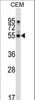 PALMD Antibody - PALMD Antibody western blot of CEM cell line lysates (35 ug/lane). The PALMD antibody detected the PALMD protein (arrow).