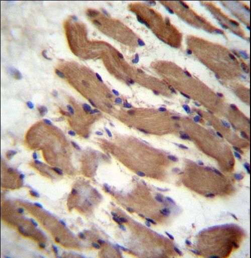 PALMD Antibody - PALMD Antibody immunohistochemistry of formalin-fixed and paraffin-embedded human skeletal muscle followed by peroxidase-conjugated secondary antibody and DAB staining.