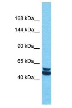 PALMD Antibody - PALMD antibody Western Blot of Thymus Tumor. Antibody dilution: 1 ug/ml.  This image was taken for the unconjugated form of this product. Other forms have not been tested.