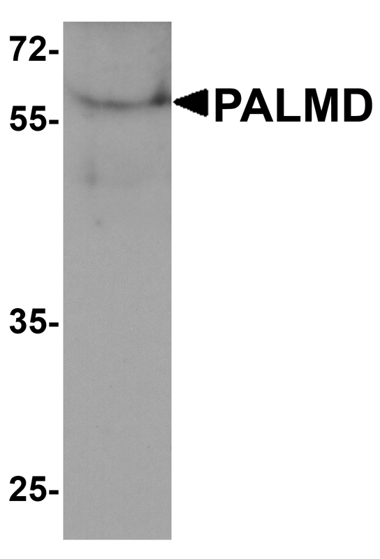 PALMD Antibody - Western blot analysis of PALMD in human bladder tissue lysate with PALMD antibody at 1 ug/ml.