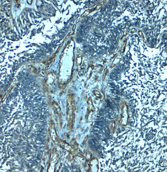 PALMD Antibody - Immunohistochemistry of PALMD in human bladder tissue with PALMD antibody at 2.5 ug/mL.